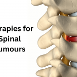 Therapies for Spinal Tumours